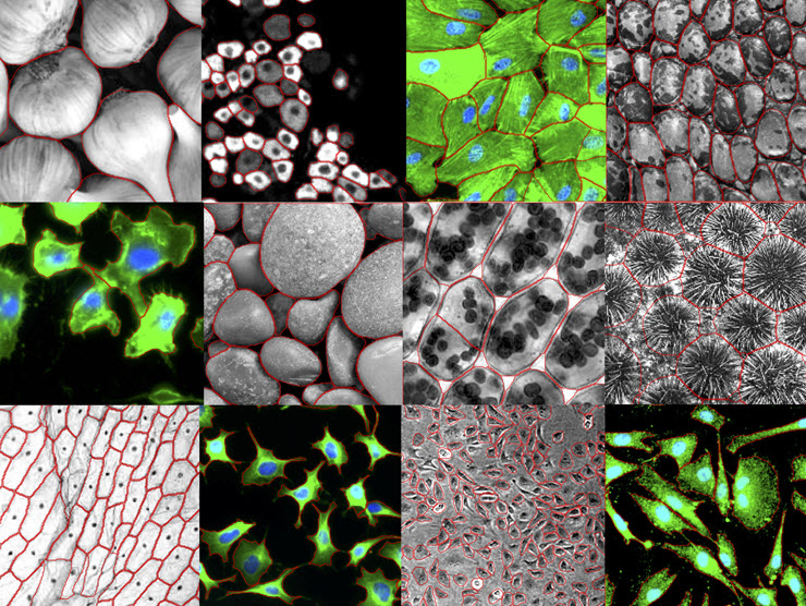 Grid of images of cells, with their boundaries outlined