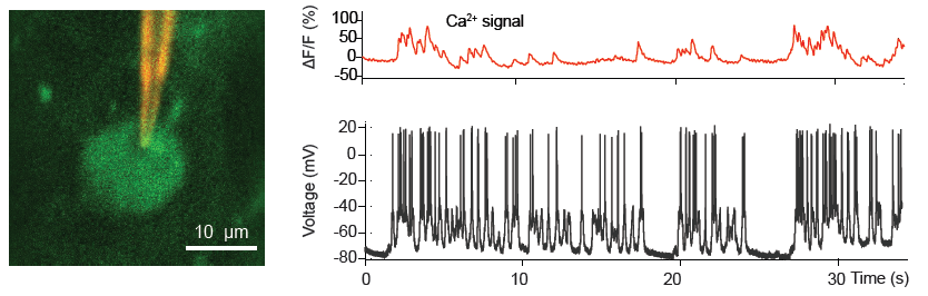 2-photon-pipette patching L2/3 pyramidal cell