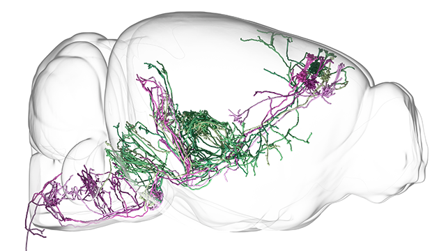 neurons sending signals to different regions of the brain