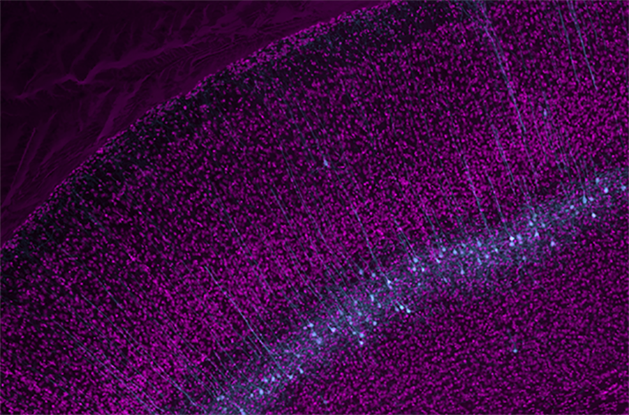 Layer 5 pyramidal neurons 2_0.png