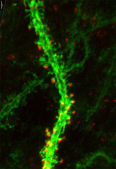 20230706_HT_GluA1spines.jpg