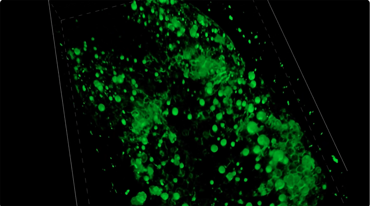 Researchers probe protein changes in the cell’s scavenger centers to