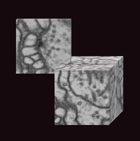 20240507_neurotransmitters1.jpg