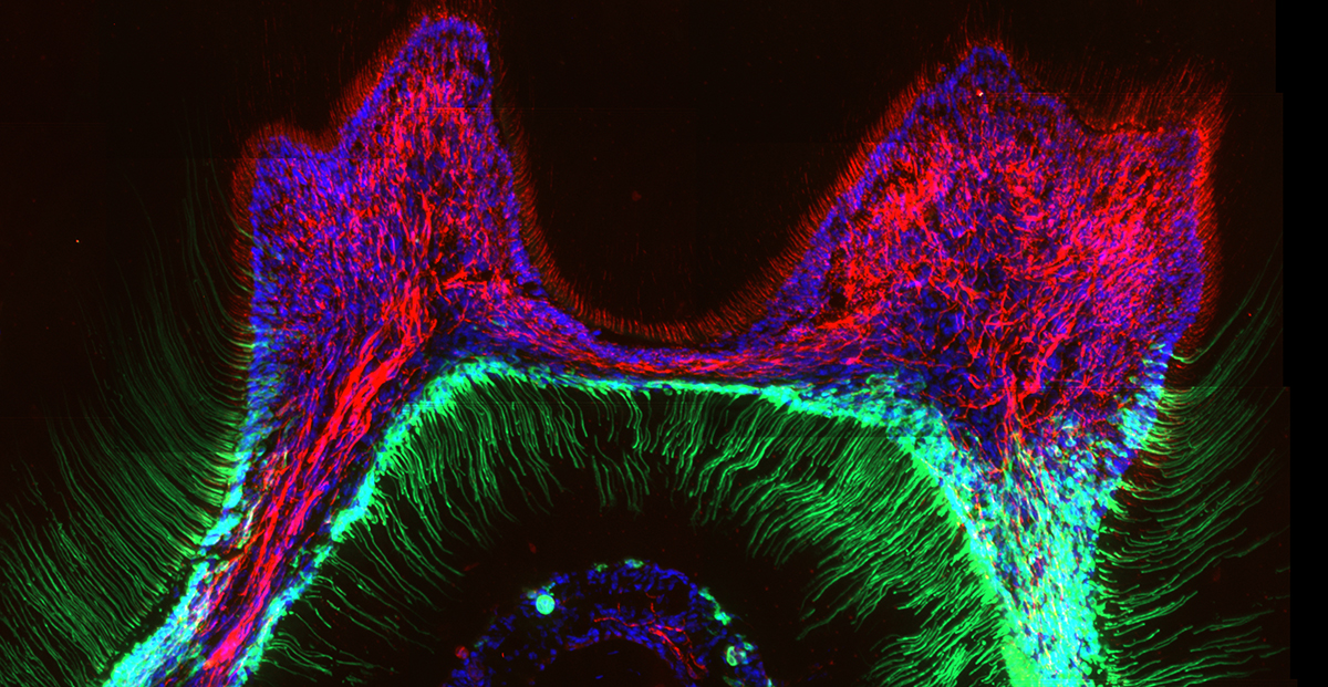 Odontoblast_cells_1200.jpg