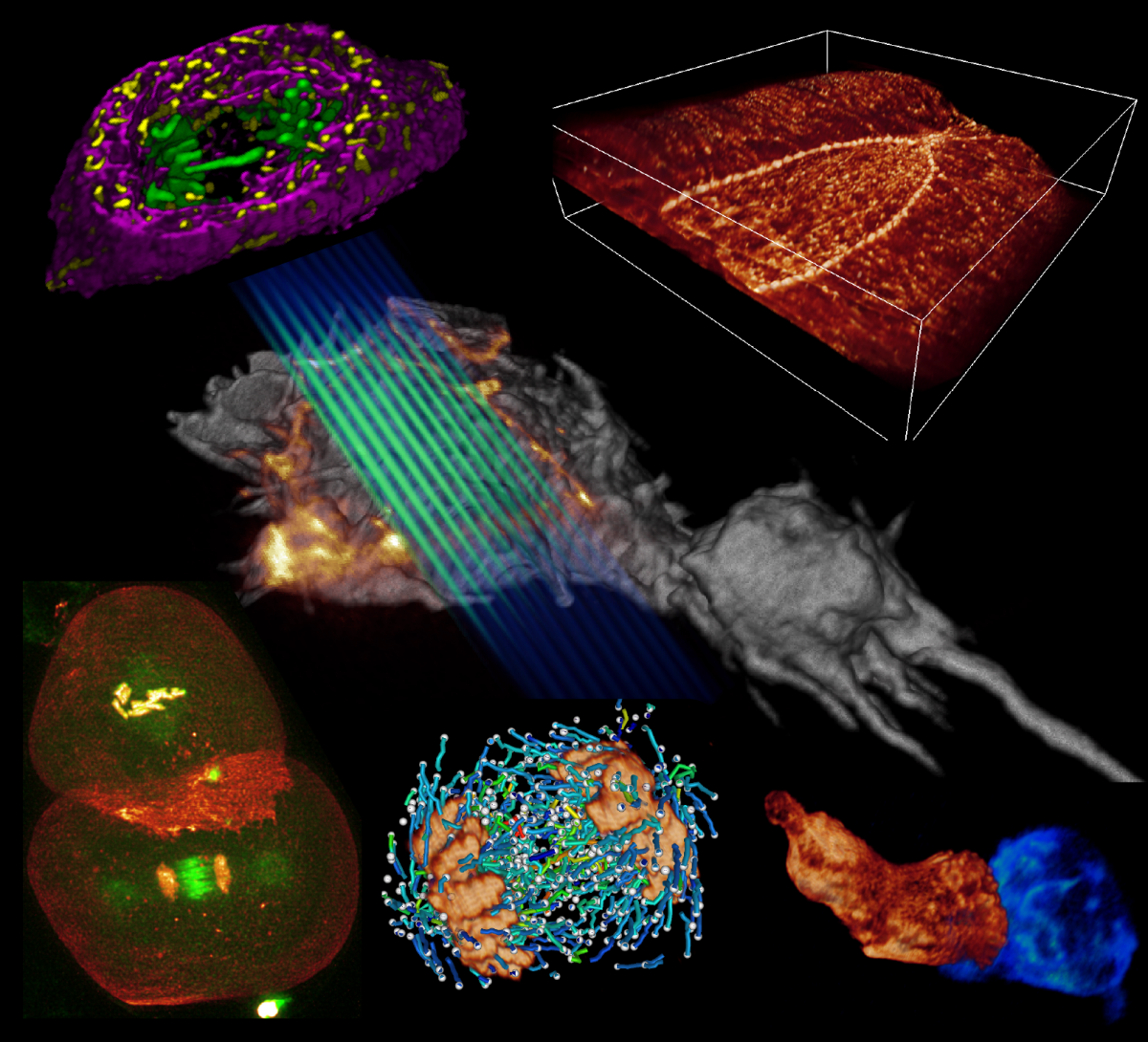 TianMing feature picture-lattice light sheet microscopy.png