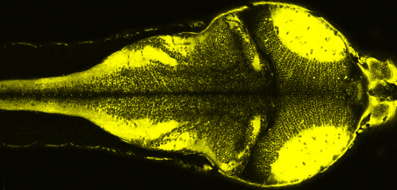 Fluorescent dye shows which neurons are active in a zebrafish