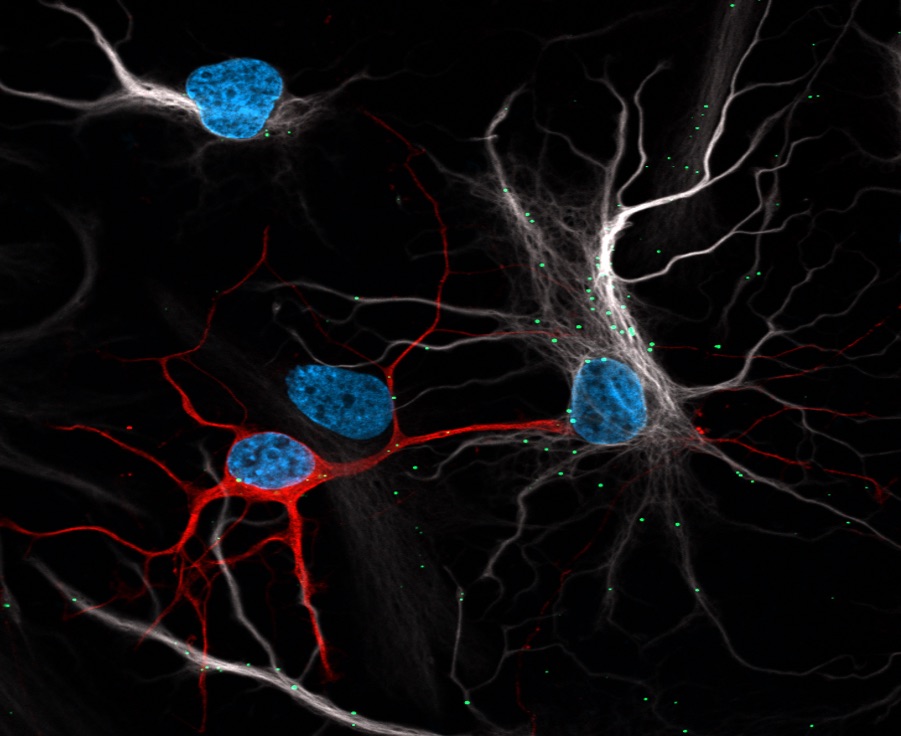 neurons+astrocytes.jpg