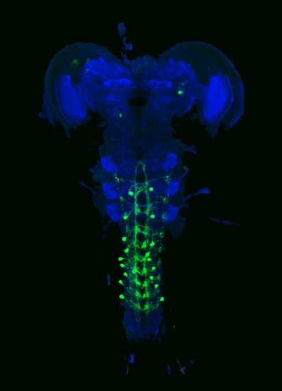 zebrafish_brain_activity.jpg
