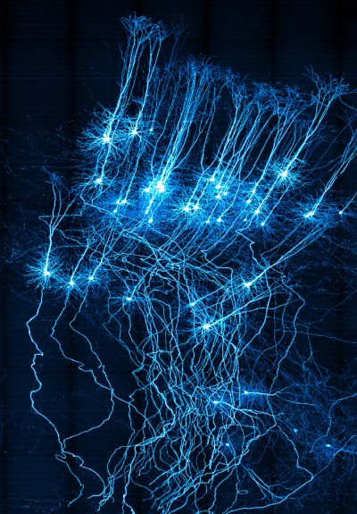 whole-brain-fluorescence.png
