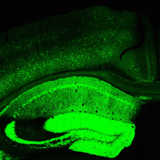 Thy1-GCaMP6 transgenic brain section