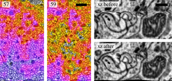 Image-Based Correction of Continuous and Discontinuous Non-Planar Axial Distortion in Serial Section Microscopy