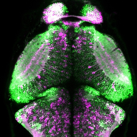 Zebrafish brain