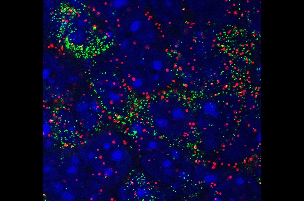 Coexpression of Agrp (green) and the sodium channel Nav1.7 in neurons in the hypothalamus